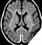 A different image drawn from the same dataset